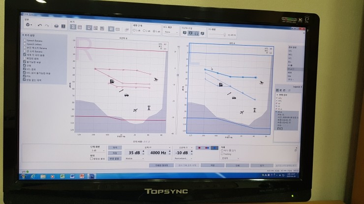 퍼스트보청기 이미지
