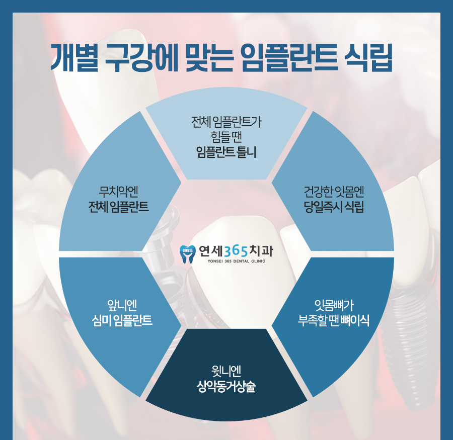연세365치과 이미지
