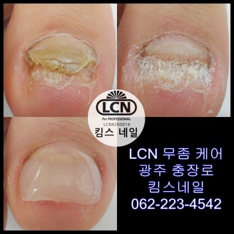 킴스케어시스템 이미지
