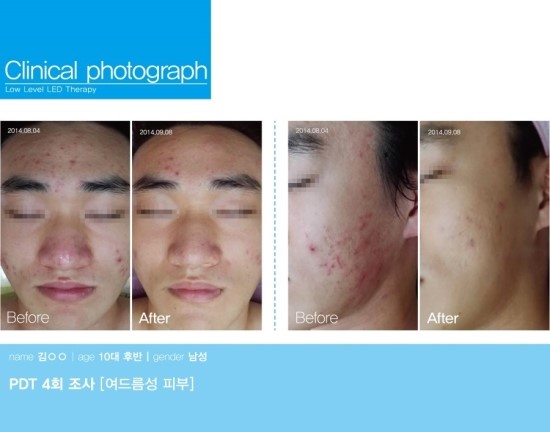 피부미인스킨케어 이미지