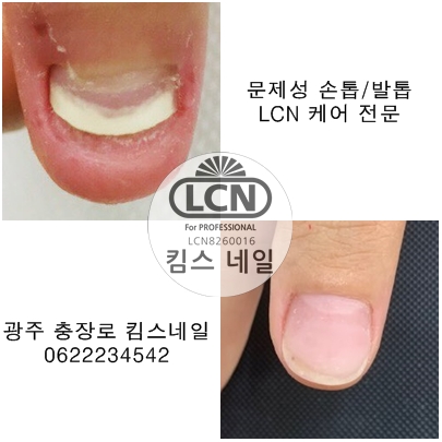 킴스케어시스템 이미지