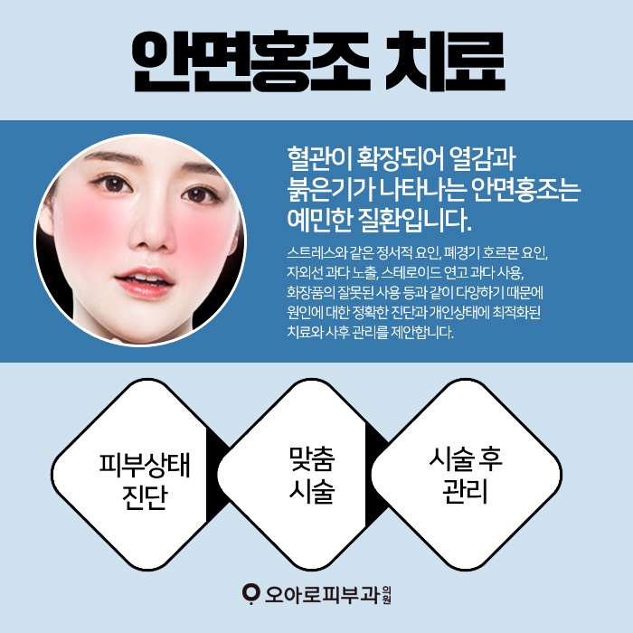 안면가스 이미지