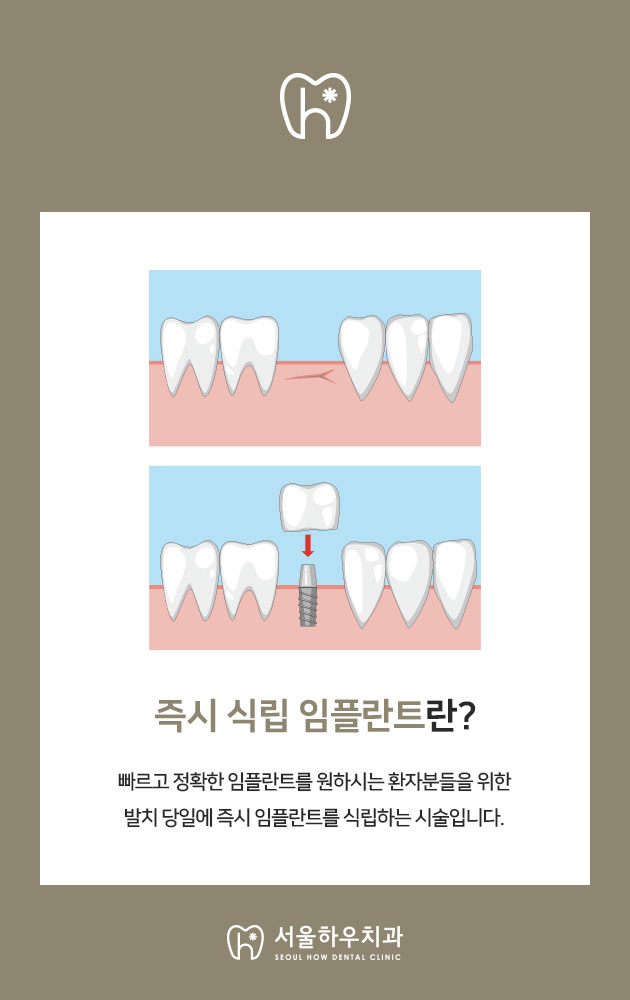 서울하우치과 이미지