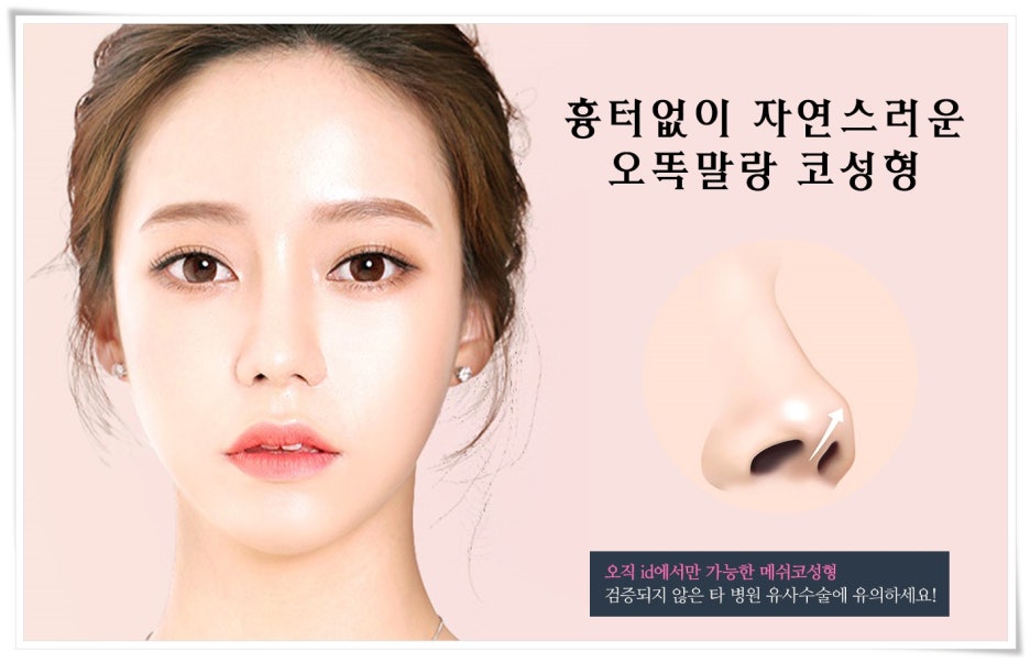 강남코성형후기 연예인같이 흉터없이 감쪽같이 : 네이버 블로그