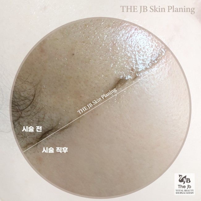 제이비뷰티 이미지