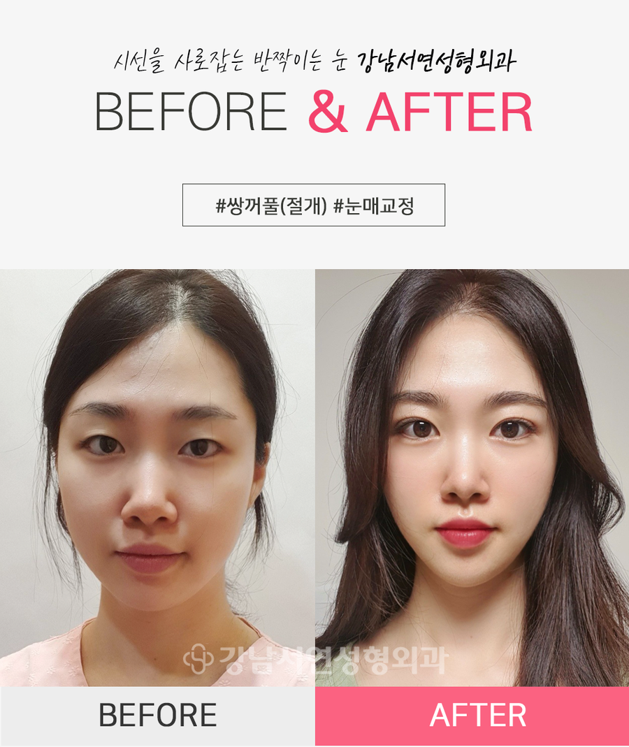 리얼성형외과 이미지