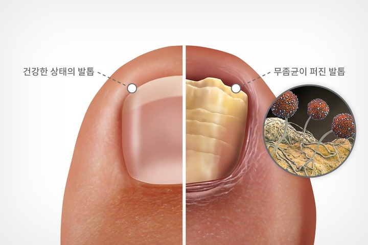 오오샵 이미지