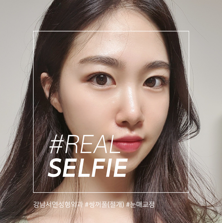 리얼성형외과 이미지