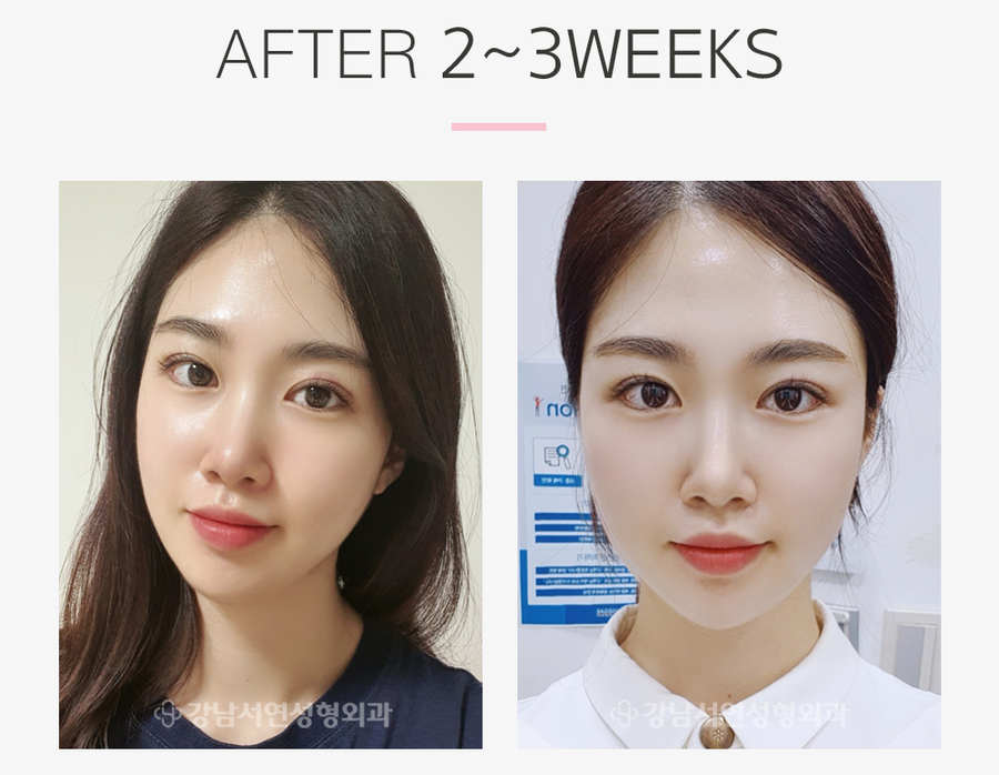 리얼성형외과 이미지