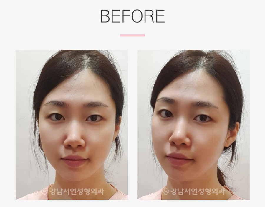 리얼성형외과 이미지
