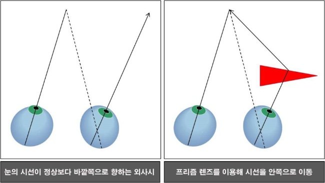 프리즘플러스 이미지