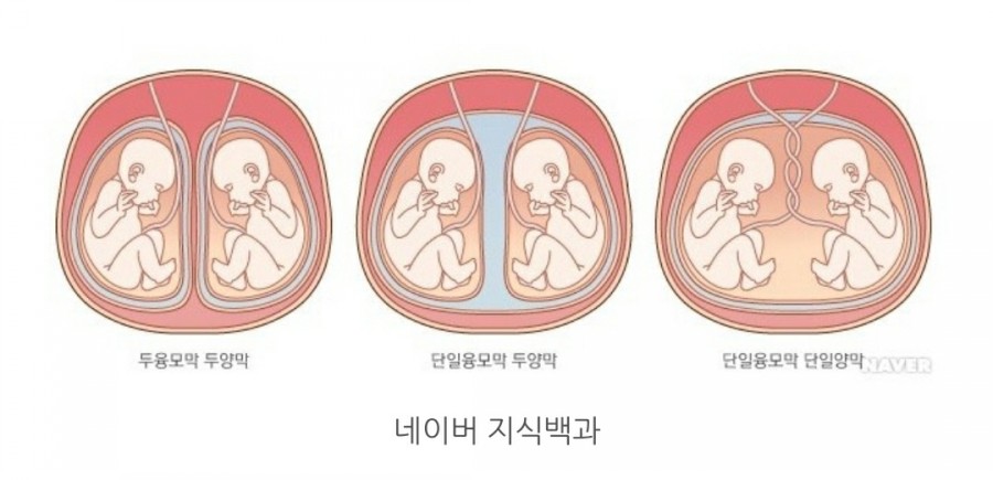 [임신 기록] 쌍둥이 태아 보험 가입, 쌍둥이-단태아 보험 비교, 실비+현대해상+동양생명, #내돈내산 :) : 네이버 블로그