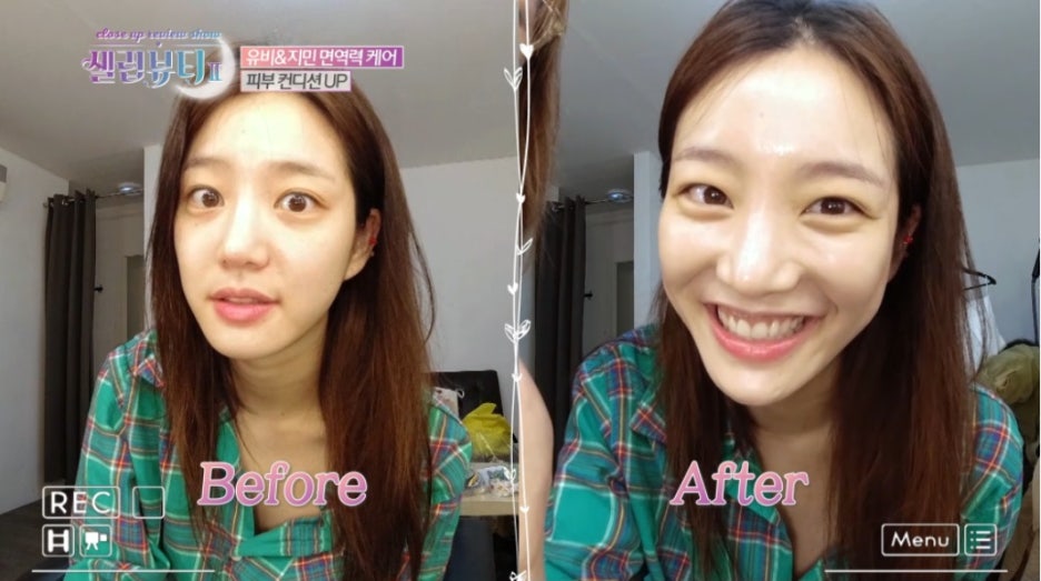 션스킨케어 이미지