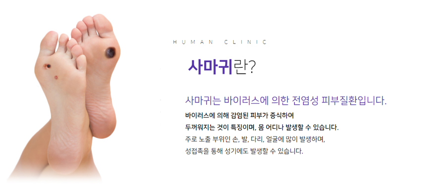 휴먼피부과의원 이미지