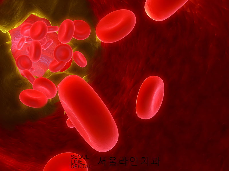 여자임질증상 원인과 대처방법 : 네이버 블로그