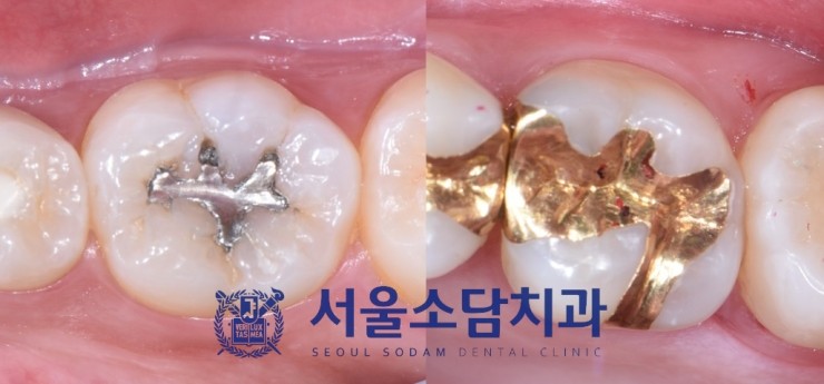 서울소담치과 이미지