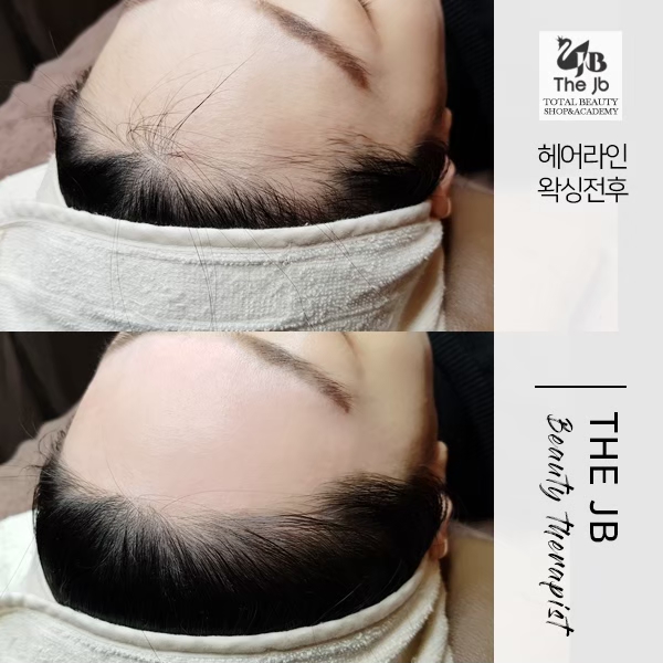 제이비라인 이미지