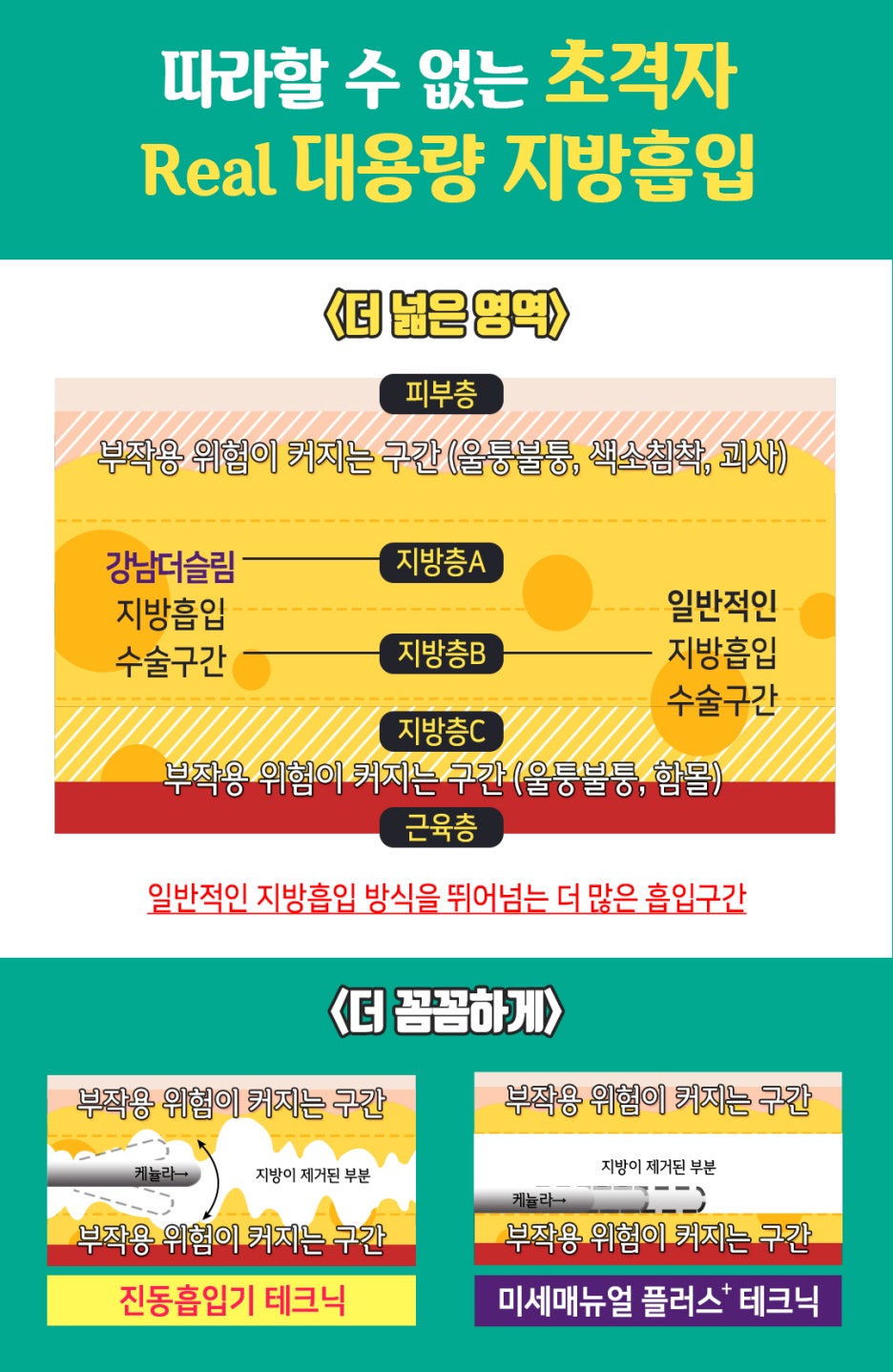 강남더슬림의원 이미지