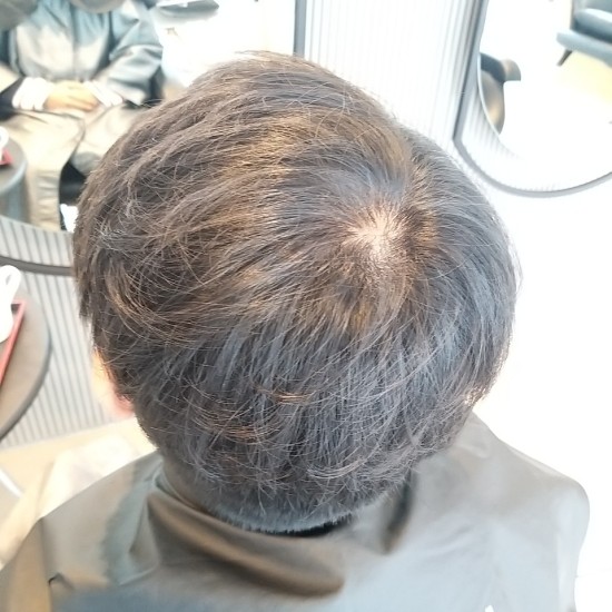 헤어바이칸 이미지