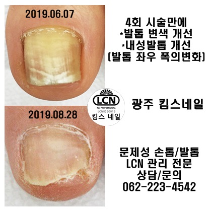 킴스케어시스템 이미지