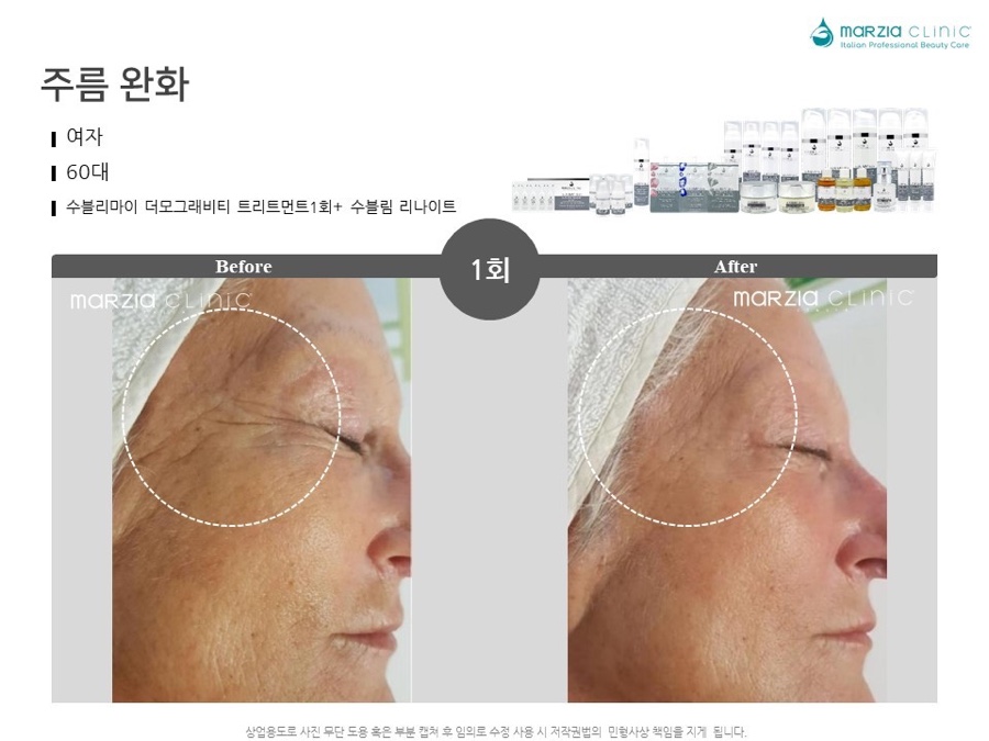 수블리 이미지