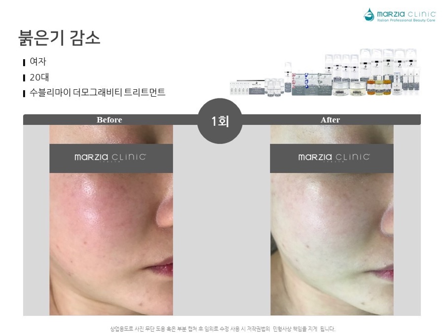 수블리 이미지