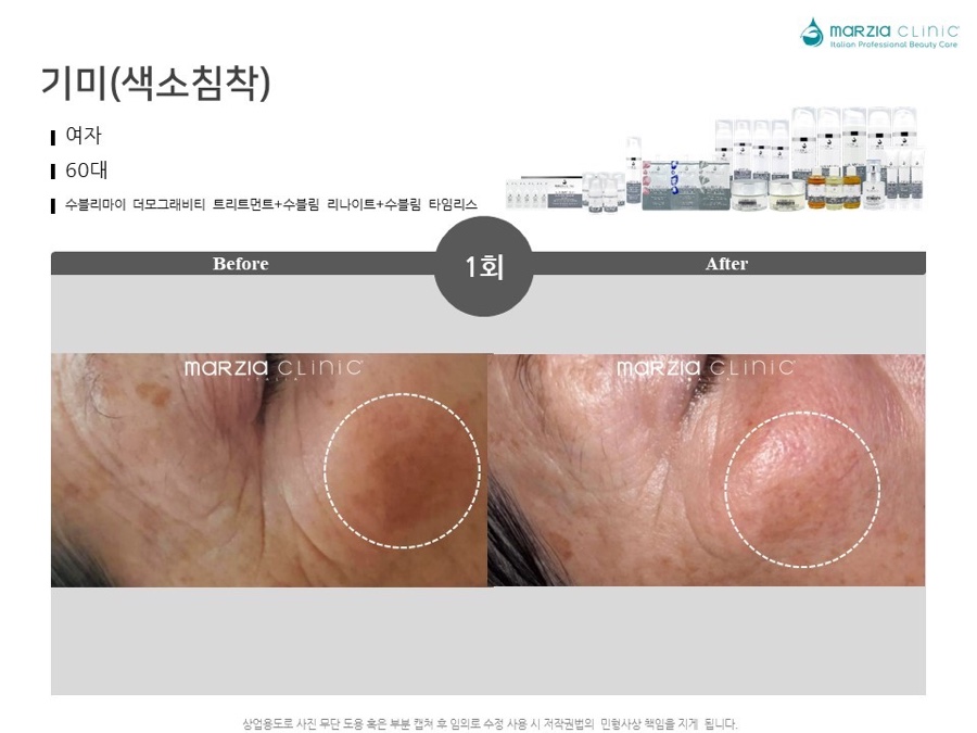 수블리 이미지