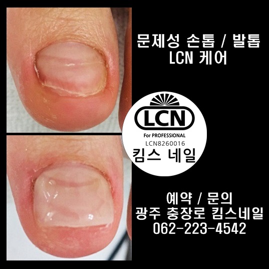 킴스케어시스템 이미지