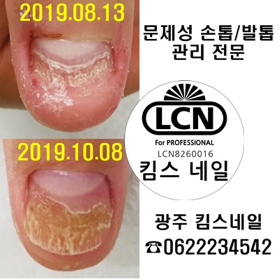 킴스케어시스템 이미지