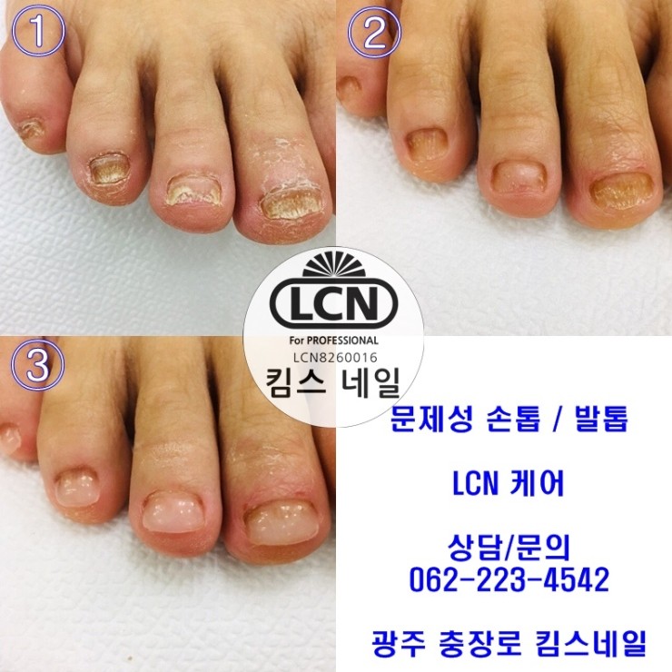킴스케어시스템 이미지