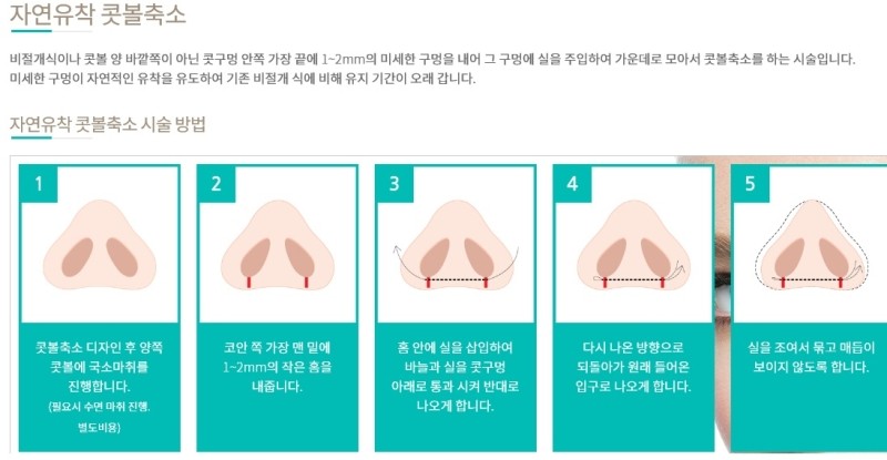 리얼성형외과 이미지