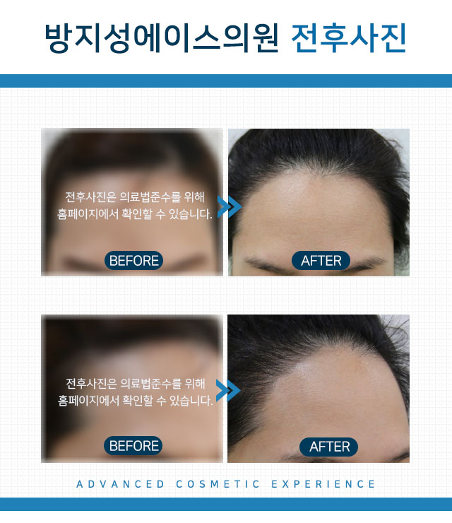 방지성에이스의원 이미지