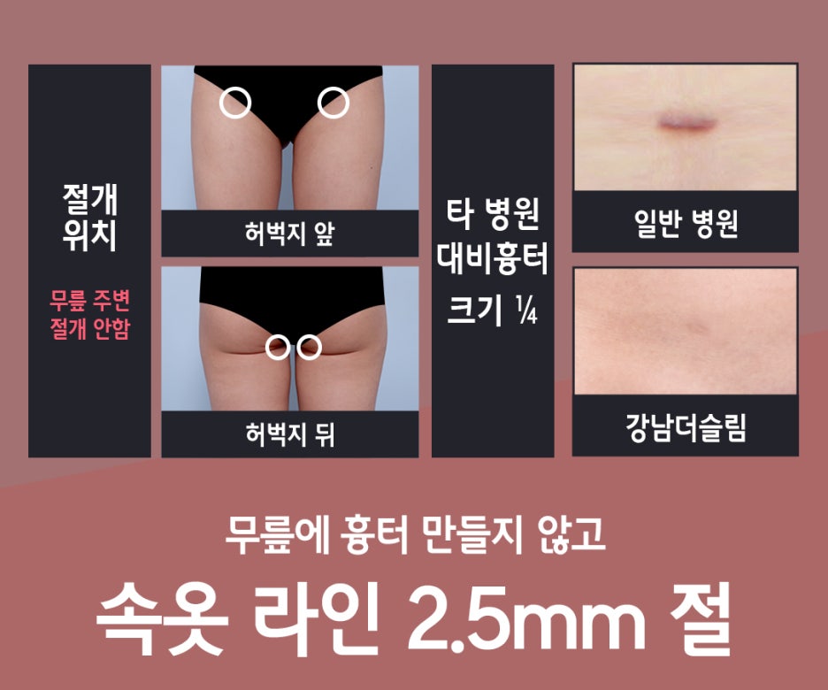 강남더슬림의원 이미지