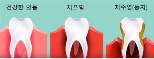 미플란트치과 이미지