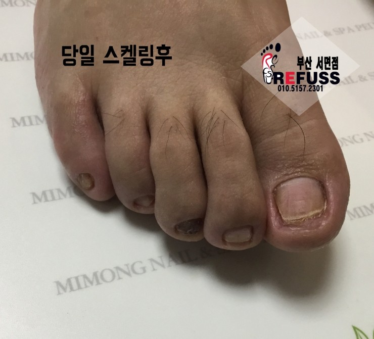 미몽 이미지