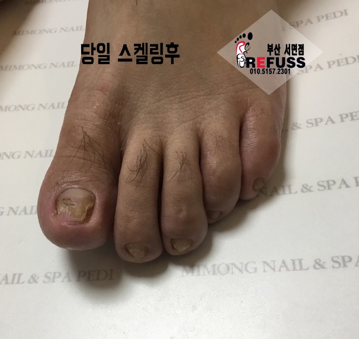 미몽 이미지
