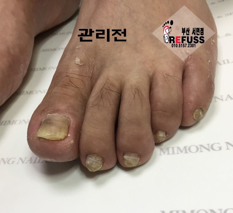 미몽 이미지