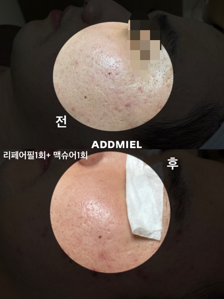 미엘피부관리 이미지