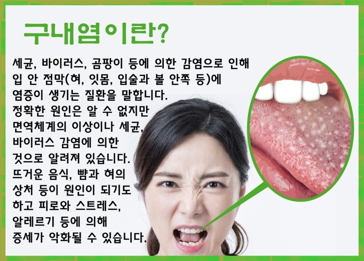 입천장 염증 해법, 이것은 무엇일까? : 네이버 블로그