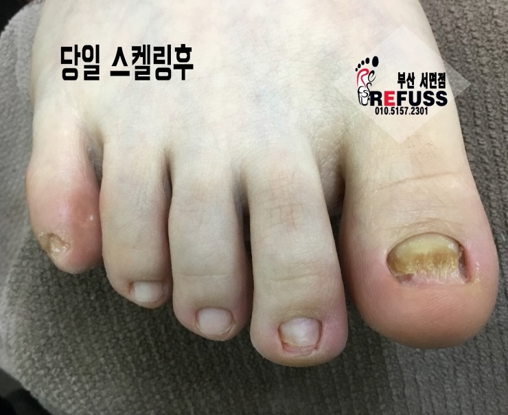 미몽 이미지