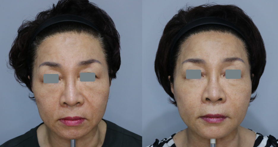 대한미용성형레이저의학회 이미지