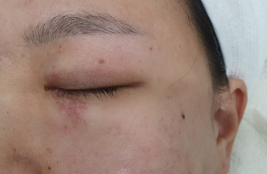 myskin피부과 이미지