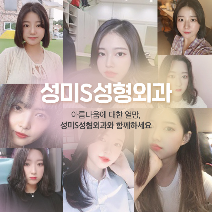 성미에스성형외과 이미지
