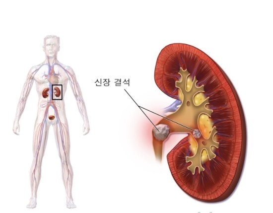 탑연합비뇨의학과의원 이미지