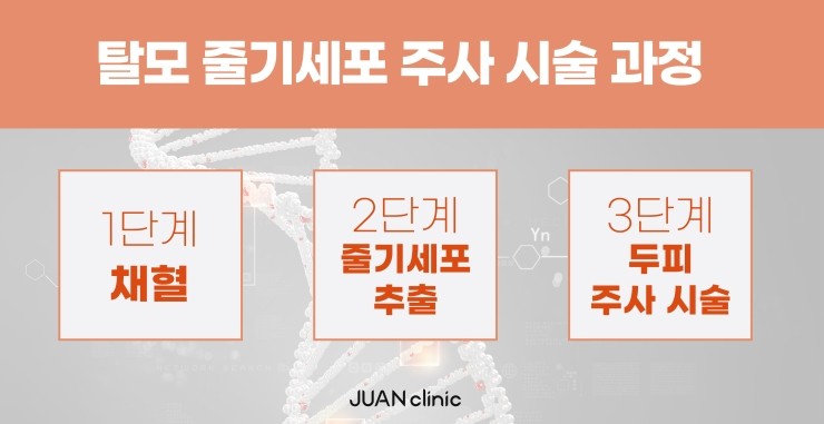 주앤헤어 이미지