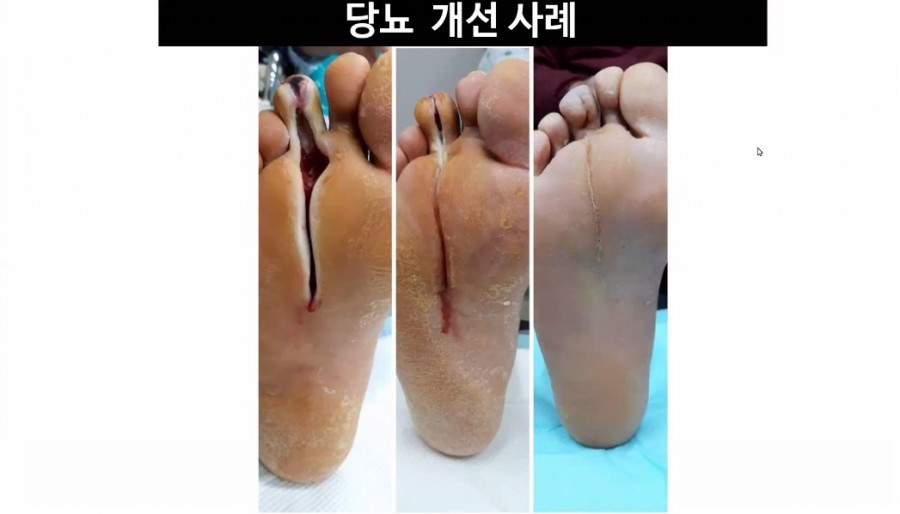 진크린 이미지