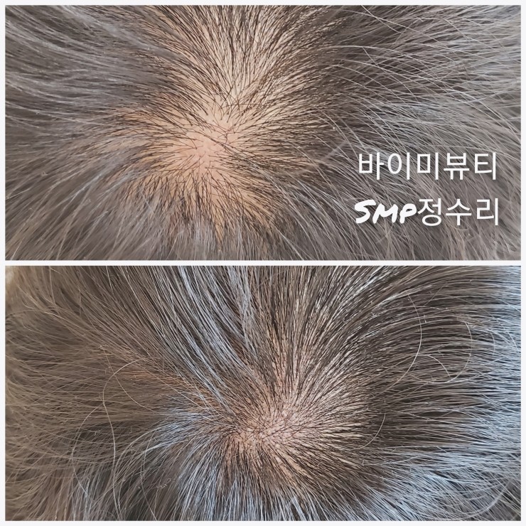 뷰티,바이미 이미지
