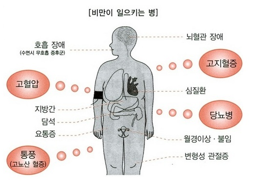 헬스중독 이미지