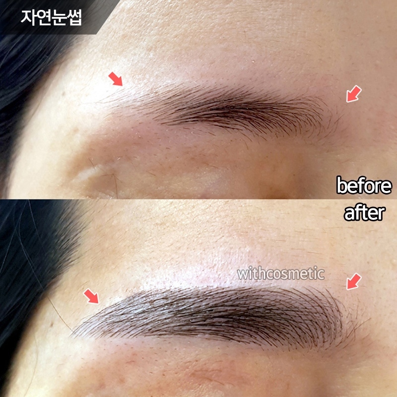 첨단위드 이미지