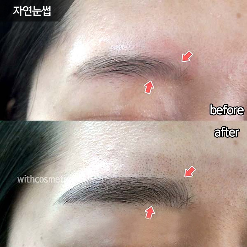 첨단위드 이미지